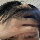 세리미