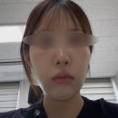 대전올타이트리프팅 나는솔로 순자리프팅 키닥터원장님 내돈내산후기