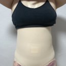 멍이가 웃통벗는날 | 복부지방흡입 당일부터 일주일차까지 후기 (통증, 붓기, 비용, 부작용)