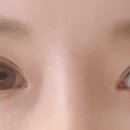 티탑콘텍트 이미지