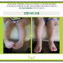 아이레그플러스의원 네이버블로그