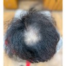 경북에서 남자정수리탈모고객님 단골이되어 매번찾아주셔서 감사합니다 / 부산경남경북남해전라전북충남충북경기강원서울제주 이미지