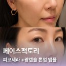 펄피부과 | 기미 잡티 홈케어 페이스팩토리 피코세라 멜라펄 기미앰플 토닝팩 5일 사용 후기