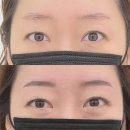 리얼뷰티 | 의정부 콤보눈썹｜민락동 뷰티웨일 리얼후기