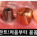 뉴욕화이트치과 이미지