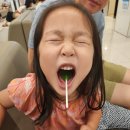 다보아 안경 | 5살(만 4세) 아이 약시/난시로 교정 안경 착용 후 12개월 만에 한쪽 눈 목표 시력 달성!