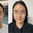 라인미 이미지