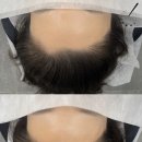 이미지헤어라인 이미지