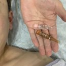 청주 가경동 피부관리 퀸스킨앤바디 /웨딩케어 리프팅...V-Key 페이셜 윤곽관리 후기 1...
