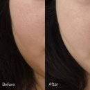 버스정류소_발산역2번출구 | [마곡 스킨타임스파] 발산역 웨딩관리 예신 1:1 맞춤 트러블 화이트닝 윤곽관리 솔직후기