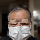 더블유유치원 | 대구 상안검 수술 상인동 더블유안과 노인 상안검 안검하수 수술 비용 내돈내산 후기