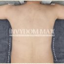 퐝스 스킨 앤 왁싱