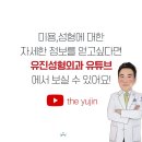 소노트랜스 이미지