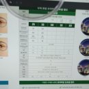 아이스타안경 이미지