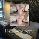 에이치앤비(H&B)펜션 | 강남 예신관리 골기경락 윤곽관리 잘하는곳 에이치앤비 에스테틱 솔직후기