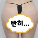일라스의원 네이버블로그
