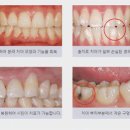 연세올바른치과의원 네이버블로그