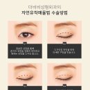 티포인트성형외과의원 이미지