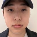 잠실역 4번출구(앞) | 잠실새내역 스킨보톡스+턱보톡스 솔직후기
