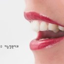 페로치아