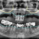 하시온치과의원 이미지
