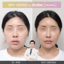 이유구강악안면외과 네이버블로그