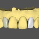 이프라임치과기공소 이미지