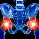 올바른마디튼튼의원 이미지