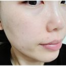 설브천안성성점 | 천안성성동피부관리/여드름 집중 관리 ! 플리즈마 관리 받으러 '설브천안성성점'방문 후기