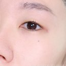 준메디케어 | 봄 외부 자극! 메디솝 B5 크림으로 장벽 케어