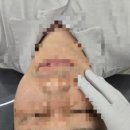 효도프로젝트! 울산피부관리 만족도 100% 해리스뷰티 후기