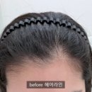 헤어라인까지 잘하는 강남 눈썹 맛집 르아델뷰티 후기