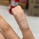 LH의원 | 진주 LH의원 방문 후기 - 조갑주위염 치료