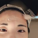 왕십리 | 디유에스테틱 좁쌀 여드름 압출 가격 후기, 왕십리 피부관리