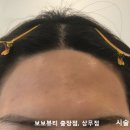 규 헤어라인
