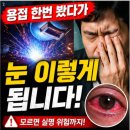 송탄성모안과의원 네이버블로그