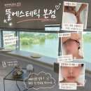 웨딩뜰 | 평택웨딩관리 뜰에스테틱 본점 예비신부 윤곽관리 후기