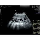 씨유 서산동문빌리지점 | [일상] 9월의 첫번째 이야기