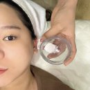 대구미백관리 뷰티수에서 플라즈마 받은 후기