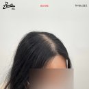 레이븐스칼프 이미지