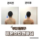 라인스킨앤바디 - 노원구 상계동 | 부산 동래구 예신 상체라인 관리 후기, 비본스킨앤바디 방문기