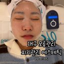 B10-1 | 대구 모공관리 B10에스테틱 블랙헤드 피지제거 후기