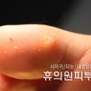 휴의원 네이버블로그