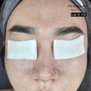 알레그라 | 계룡 피부관리는 어디?! 알레그라도&amp;르미 원장의 시술 솔직 후기