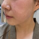 속편한권내과의원 | 대구 쿨페이즈 리프팅, 달서구 죽전동 피부과 의원 시술 추천