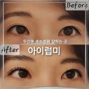 대구 수성구 두산동 노글루 속눈썹펌 유지력 좋은 아이럽미비포&amp;애프터 찐후기