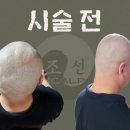 조선스칼프 이미지