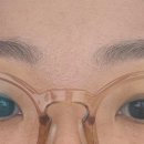 아르피온 이미지