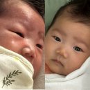 눈꼽 | 신생아 홍반, 태열, 눈꼽 개선 후기(일센치 약모밀 앰플 ,차앤맘 로션 내돈내산)
