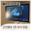 동그라미약국 | 청주 모태안 산부인과 신선배아 시험관 콩주사 이식후 당일 NK세포